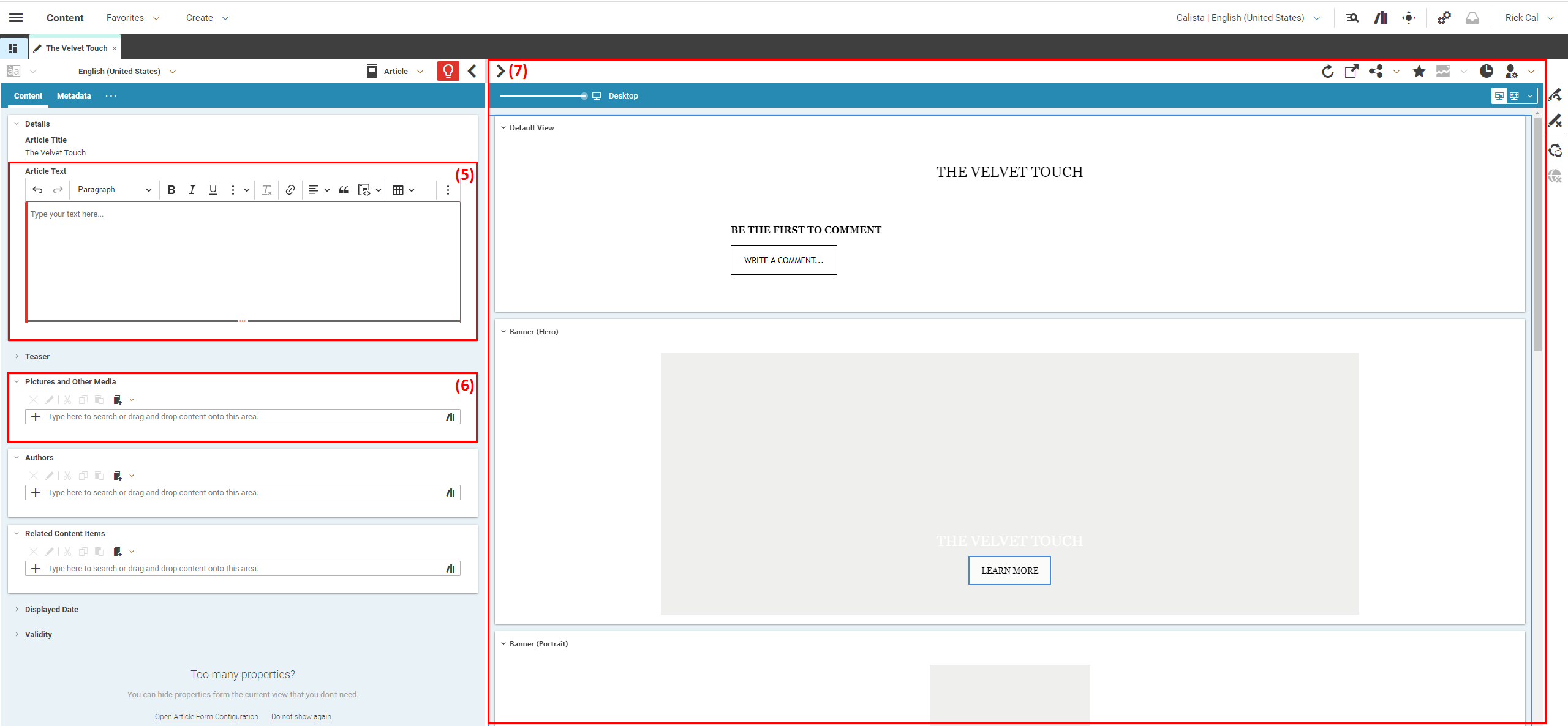 create article article field types